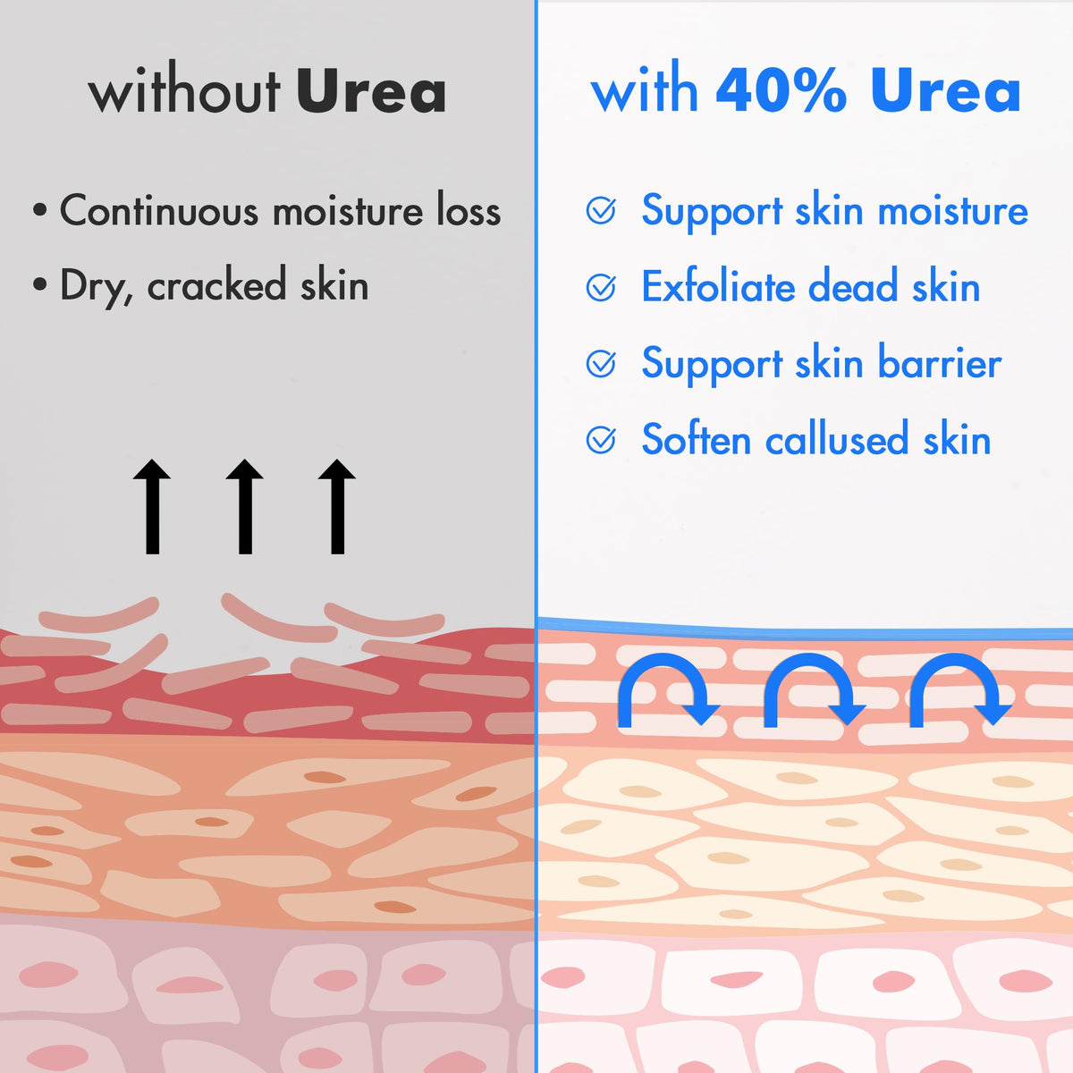Ebanel Urea Cream 40% plus Salicylic Acid 2% for Dry Cracked Feet Skin